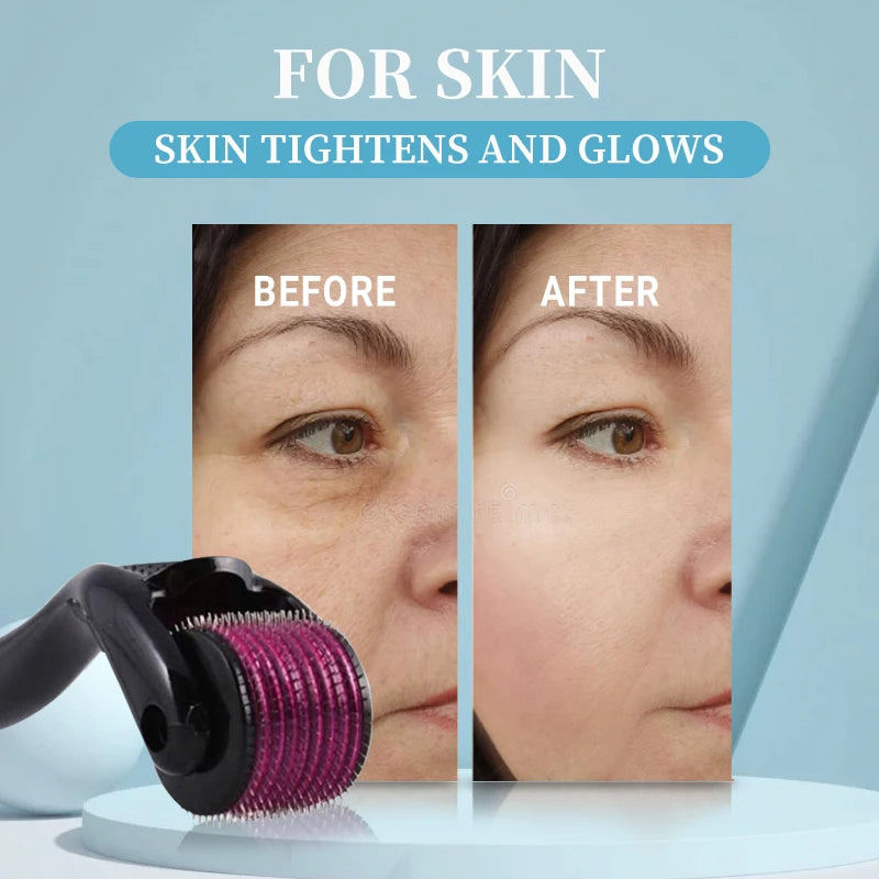 GrowRoll Derma Roller