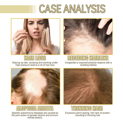Hair Growth Rosemary Oil