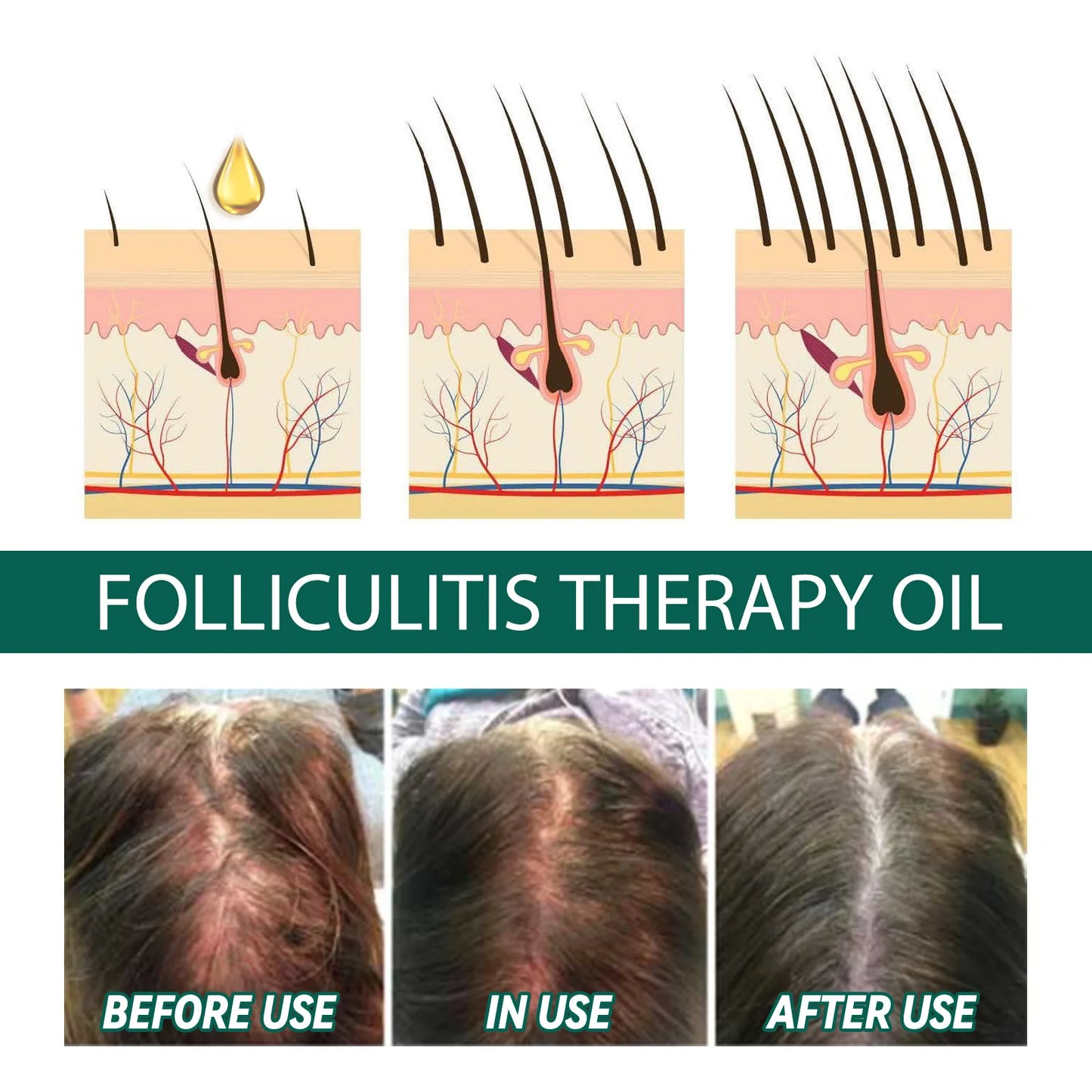Scalp Treatment Serum – Hair Growth & Anti-Dandruff