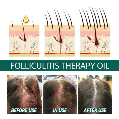 Scalp Treatment Serum – Hair Growth & Anti-Dandruff