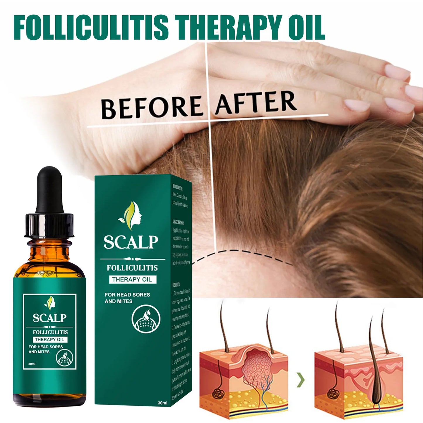 Scalp Treatment Serum – Hair Growth & Anti-Dandruff